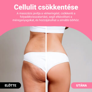 Alternative view of GUASHA – testformáló masszázshenger a cellulit és zsír látható csökkentésére
